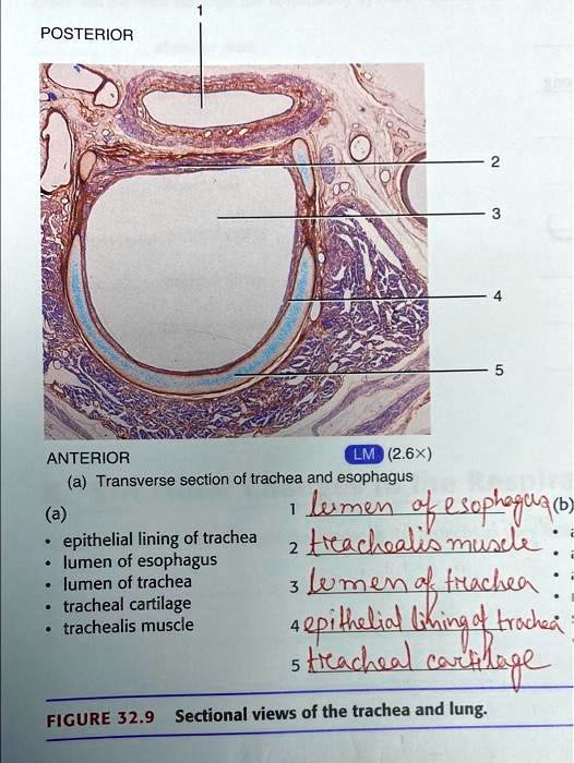 POSTERIOR ANTERIOR LM (2.6×) (a) Transverse section of trachea and ...