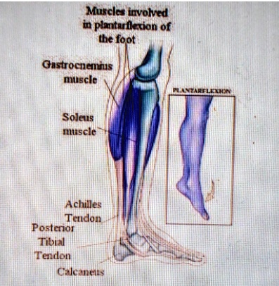 SOLVED: The image above is plantar flexion. Identify the agonist