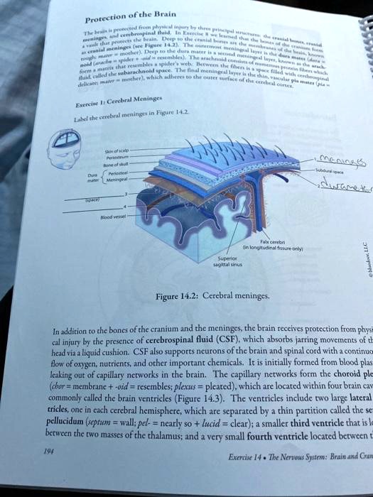 Solved: Exercise 1: Cerebral Meninges Label The Cerebral Meninges In 