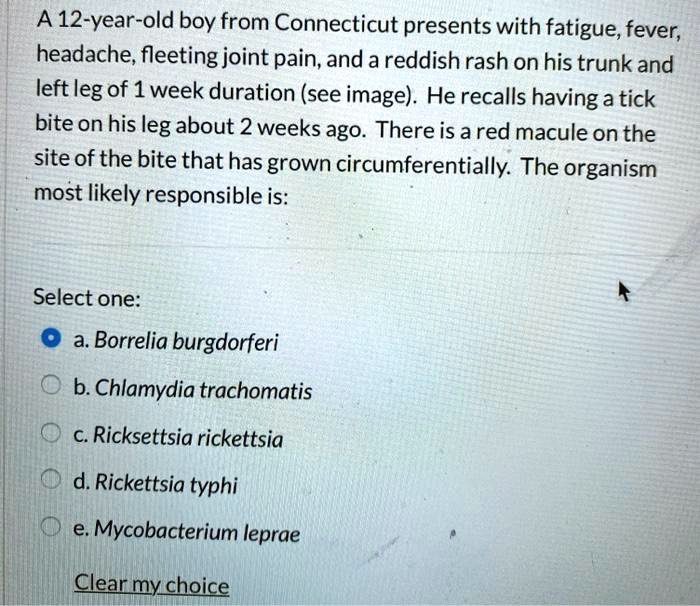 A 12-year-old boy from Connecticut presents with fatigue, fever, headache, fleeting joint pain, and a reddish rash on his trunk and left leg of 1 week duration (see image). He recalls having a tick bite on his leg about 2 weeks ago. There is a red macule on the site of the bite that has grown circumferentially. The organism most likely responsible is:
Select one:
a. Borrelia burgdorferi
b. Chlamydia trachomatis
c. Ricksettsia rickettsia
d. Rickettsia typhi
e. Mycobacterium leprae
Clear my choice