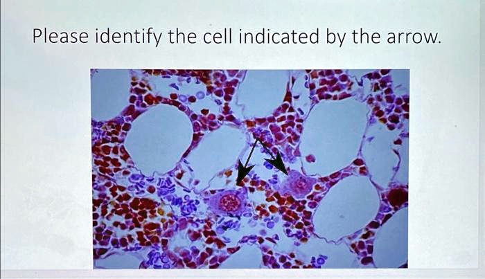 Identify The Shape Of The Cell Indicated By The Line SOLVED: Please identify the cell indicated by the arrow.