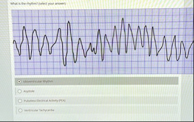 what is the rhythm select your answer idioventricular rhythm asystole ...