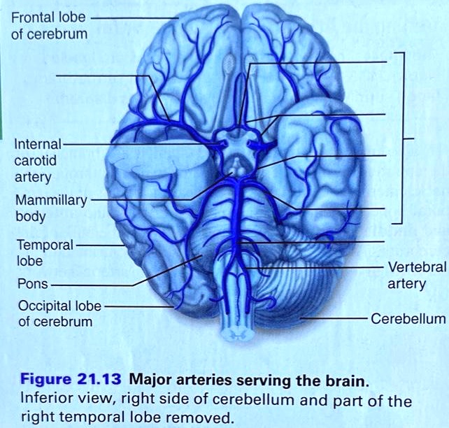 Solved: Frontal Lobe Of Cerebrum Internal Carotid Artery Mammillary 