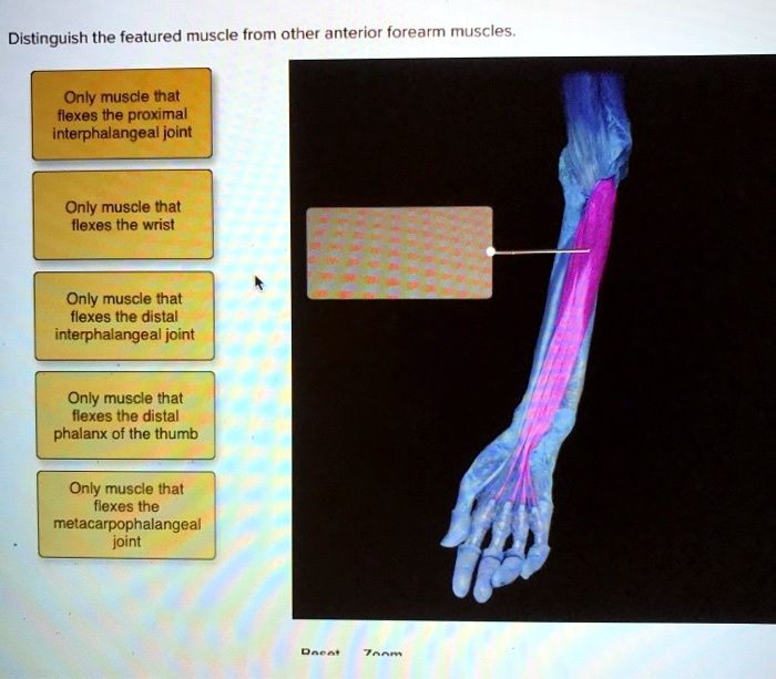 SOLVED Distinguish the featured muscle from other anterior forearm