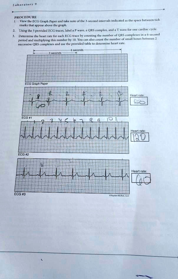 SOLVED Determine heart rate for each ECG trace. Laboratory 9 PROCEDURE