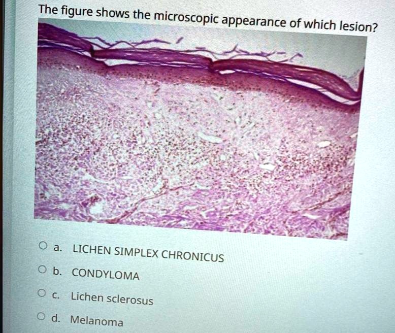 Solved The Figure Shows The Microscopic Appearance Of Which Lesion A