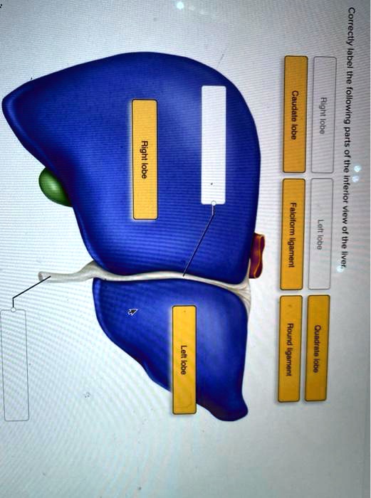 SOLVED Caudate lobe Right lobe Correctly label the following parts of the inferior view of the