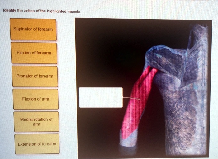 Forearm Rotation Tendon SOLVED: Please don't give wrong answers. Identify properly if you know ...