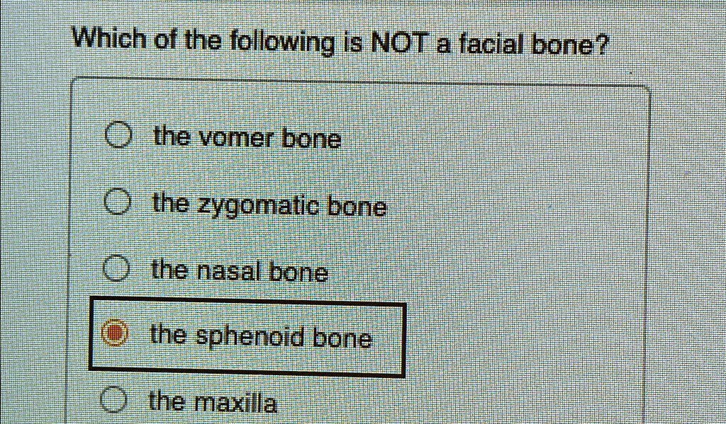 SOLVED: Which of the following is NOT a facial bone? the vomer bone the ...