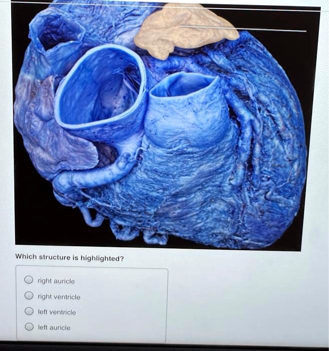 Which structure is highlighted? right auricle right ventricle left ...