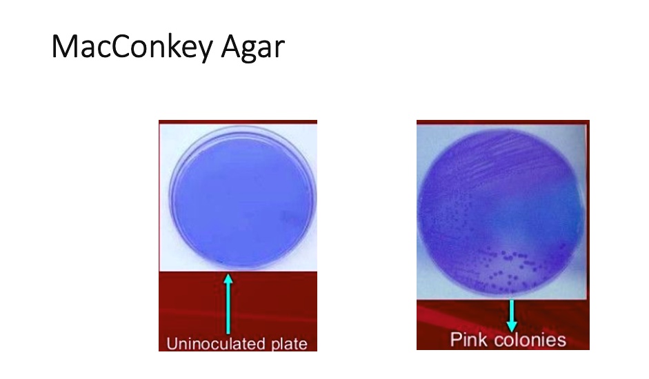 SOLVED: MacConkey Agar Uninoculated plate Pink colonies