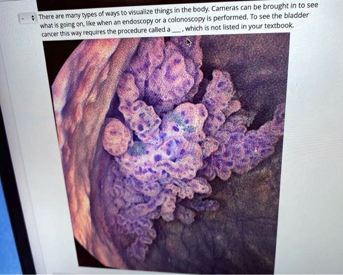 SOLVED There are many types of ways to visualize things in the body