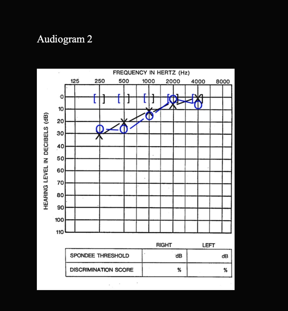 Texts: Instructions: Describe The Following Audiograms As You Would In ...