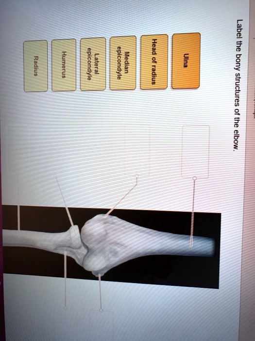 Label the bony structures of the elbow: Head, Radius, Ulna, Humerus ...