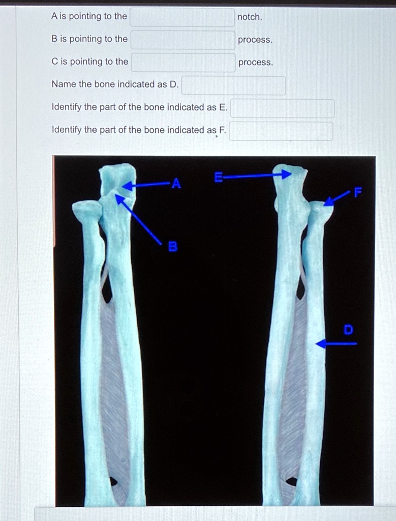 A is pointing to the notch.
B is pointing to the process.
C is pointing to the process.
Name the bone indicated as D.
Identify the part of the bone indicated as E.
Identify the part of the bone indicated as F.