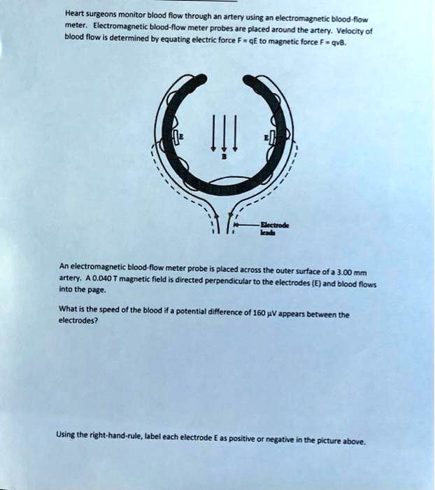 SOLVED Heart surgeons monitor blood flow through an artery using an