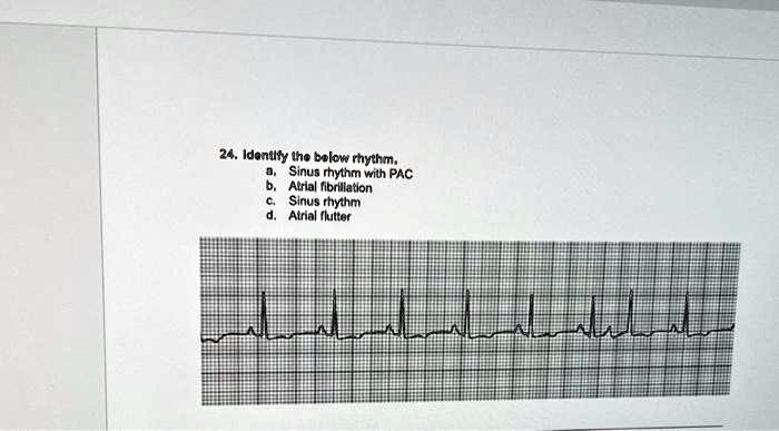24 identify the below rhythm a sinus rhythm with pac b atrial fibrillation c sinus rhythm d atrial flutter 02181