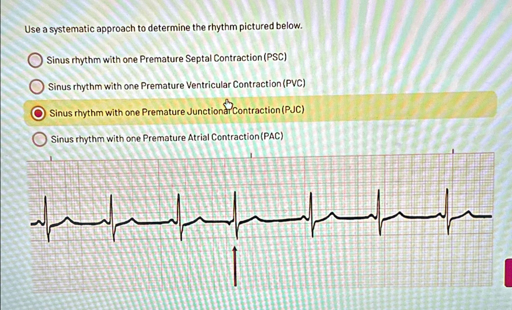 Solved Use A Systematic Approach To Determine The Rhythm Pictured Below Sinus Rhythm With One 