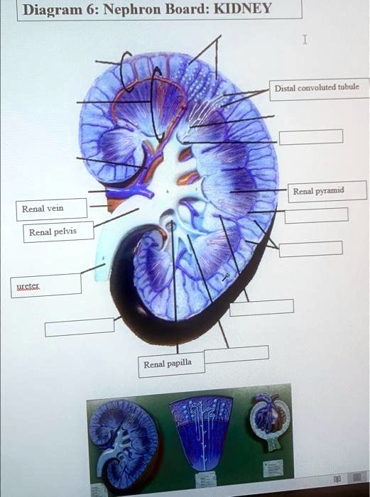 SOLVED diagram 6 Nephron Board Kidney Diagram 6Nephron BoardKIDNEY