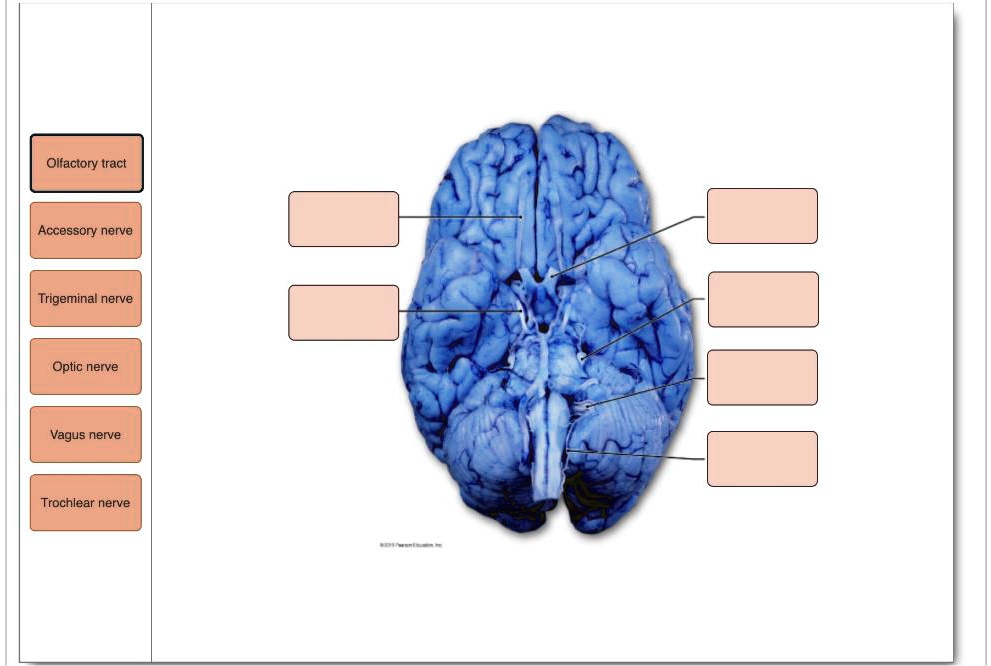 Olfactory tract
Accessory nerve
Trigeminal nerve
Optic nerve
Vagus nerve
Trochlear nerve