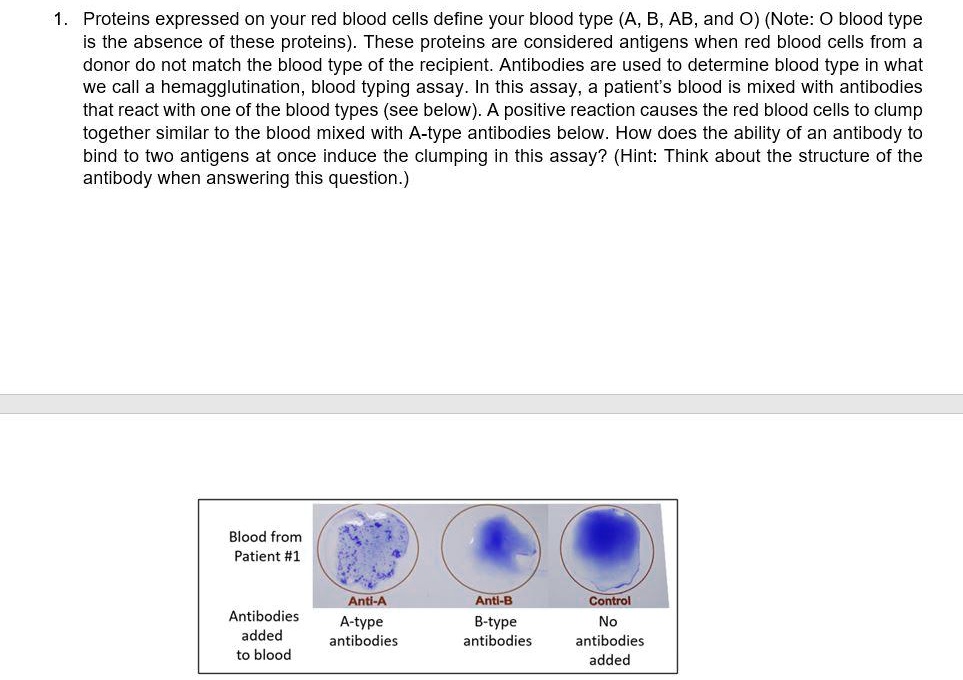 1. Proteins expressed on your red blood cells define your blood type (A, B, AB, and O) (Note: O blood type is the absence of these proteins). These proteins are considered antigens when red blood cells from a donor do not match the blood type of the recipient. Antibodies are used to determine blood type in what we call a hemagglutination, blood typing assay. In this assay, a patient's blood is mixed with antibodies that react with one of the blood types (see below). A positive reaction causes the red blood cells to clump together similar to the blood mixed with A-type antibodies below. How does the ability of an antibody to bind to two antigens at once induce the clumping in this assay? (Hint: Think about the structure of the antibody when answering this question.)
Blood from Patient #1
Antibodies added to blood
Anti-A A-type antibodies
Anti-B B-type antibodies
Control No antibodies added