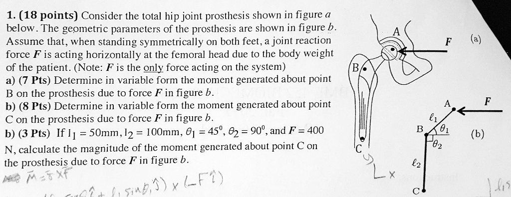 1. (18 points) Consider the total hip joint prosthesis shown in figure ...