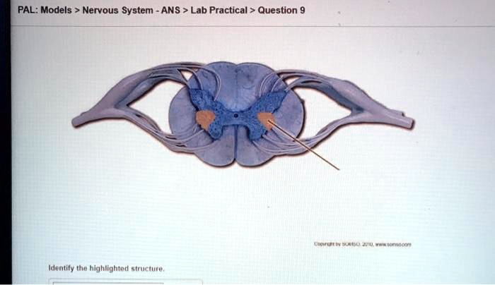 pal models nervous system ans lab practical question idemtily tha highlightod structure 51385