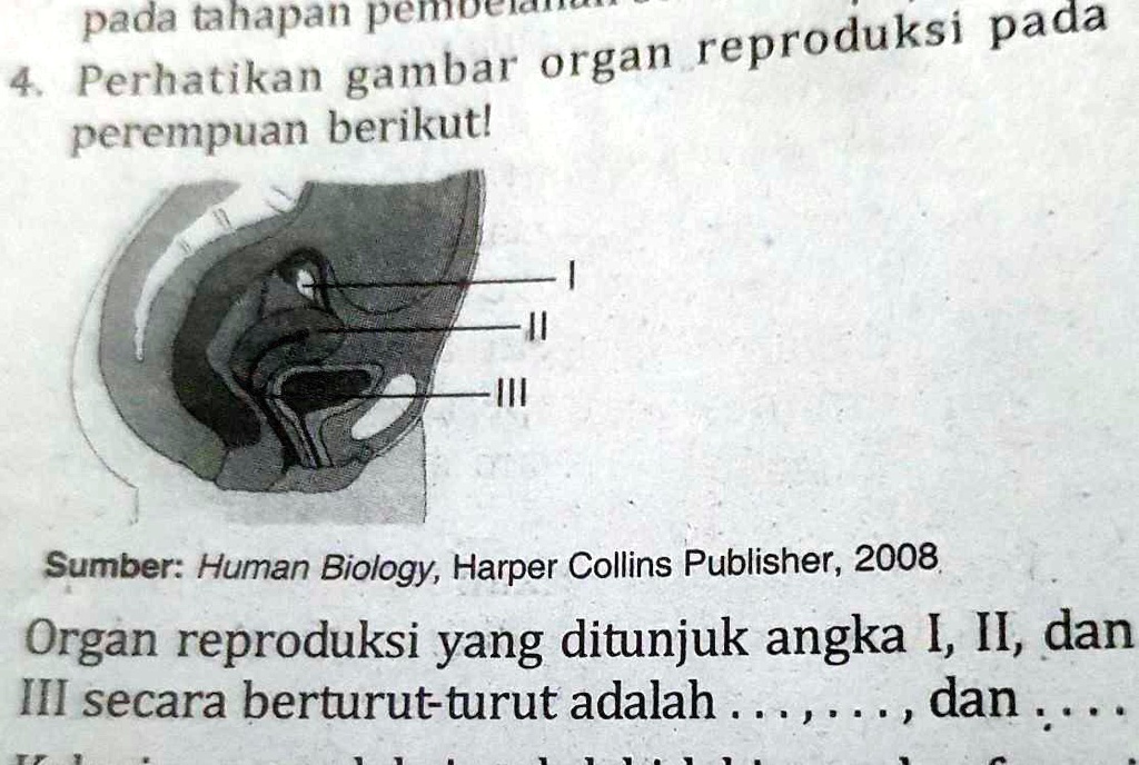 Solved Perhatikan Gambar Organ Reproduksi Pada Perempuan Berikut Organ