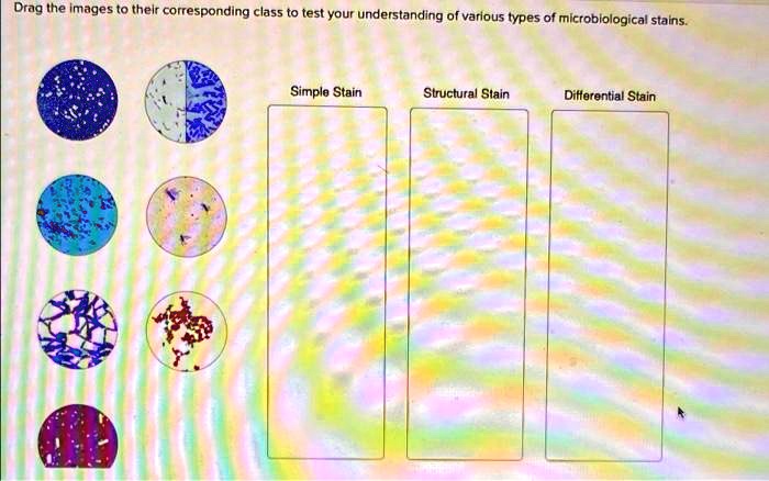 SOLVED: Simple Stain Structural Stain Differential Stain