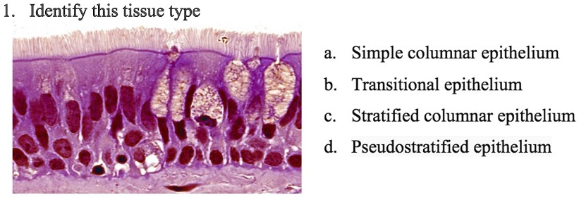 SOLVED: '1 Identify this tissue type Simple columnar epithelium b ...