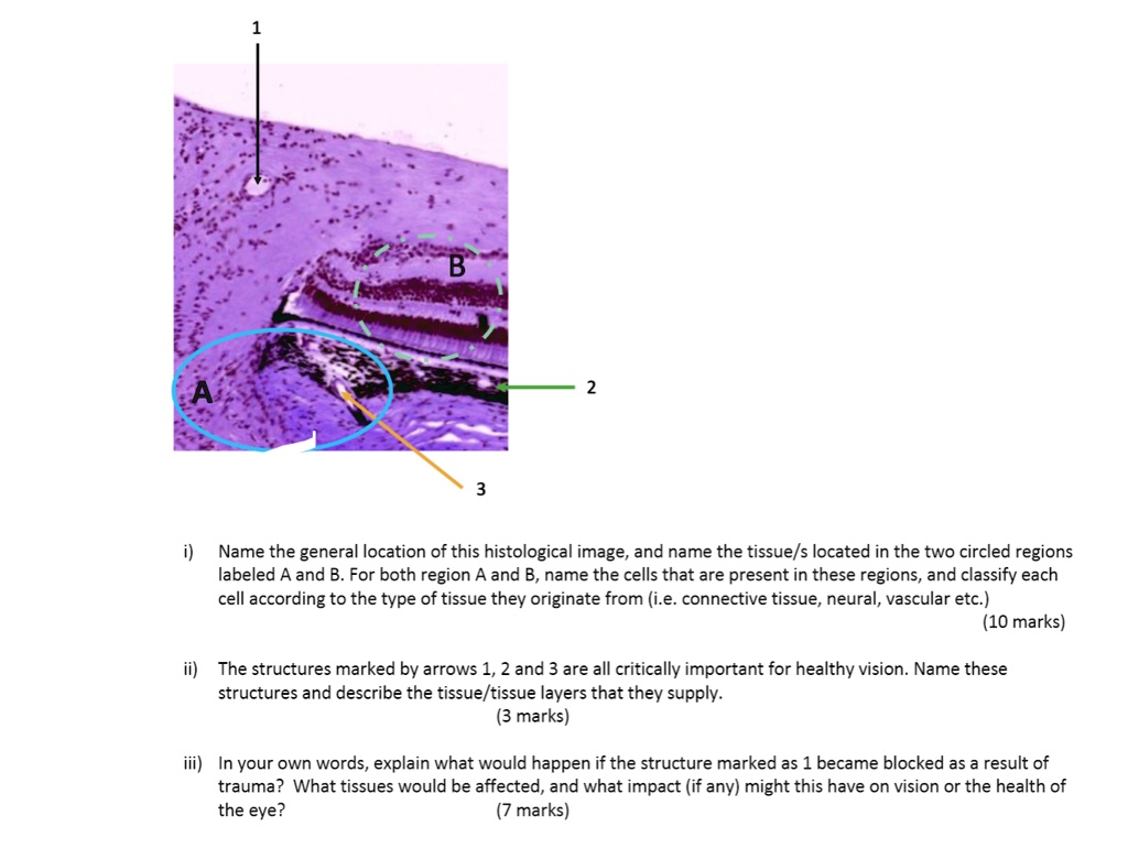 SOLVED:B Name the general location of this histological image and name ...