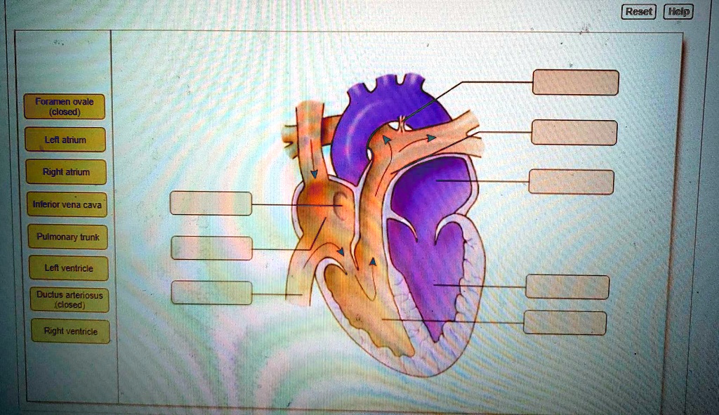 Solved: Reset Help Foramen Ovale (closed) Lefl Atrium Right Atrium 