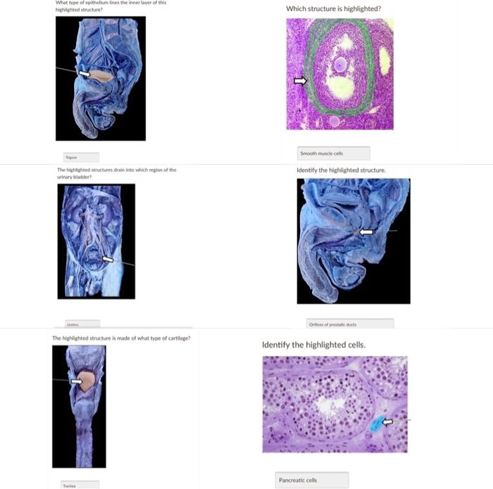 What type of epithelium lines the inner layer of this highlighted