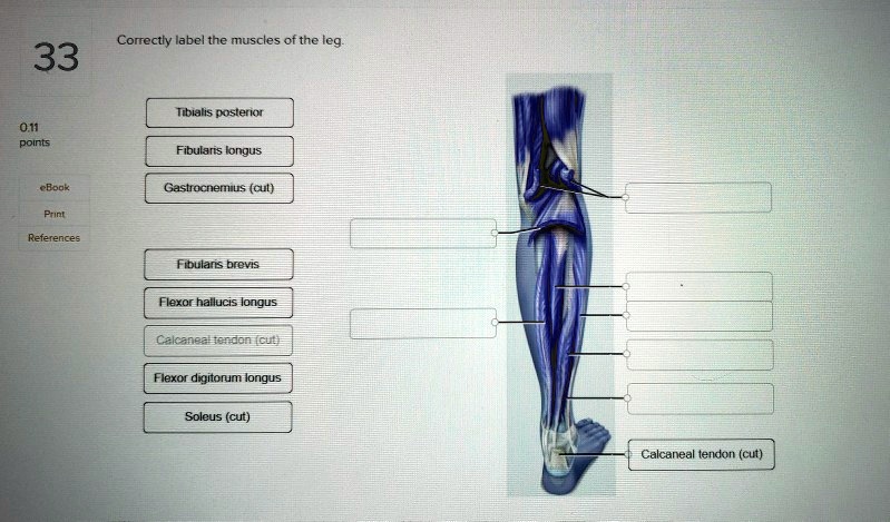 SOLVED: correctly label the muscles of the leg Correctly label the ...