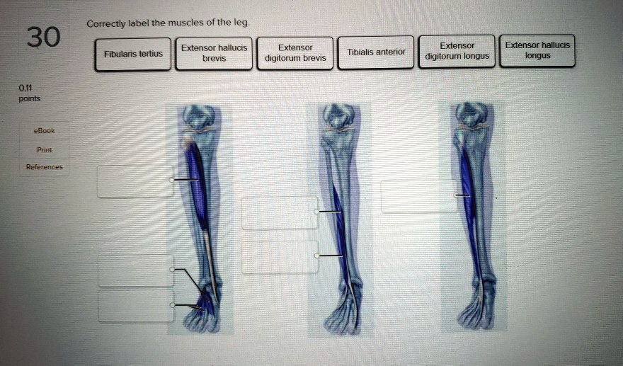 SOLVED Correctly label the muscles of the leg 30 Extensor hallucis Extensor digitorum longus
