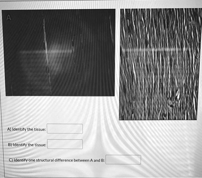 SOLVED: A) Identify The Tissue. B) Identify The Tissue. C) Identify One ...