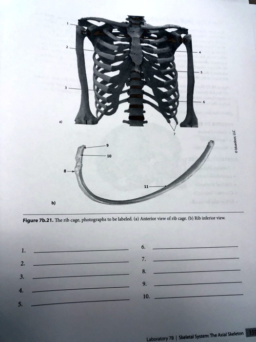 SOLVED Please help with labeling the rib cage. Figure 7b.21. The rib