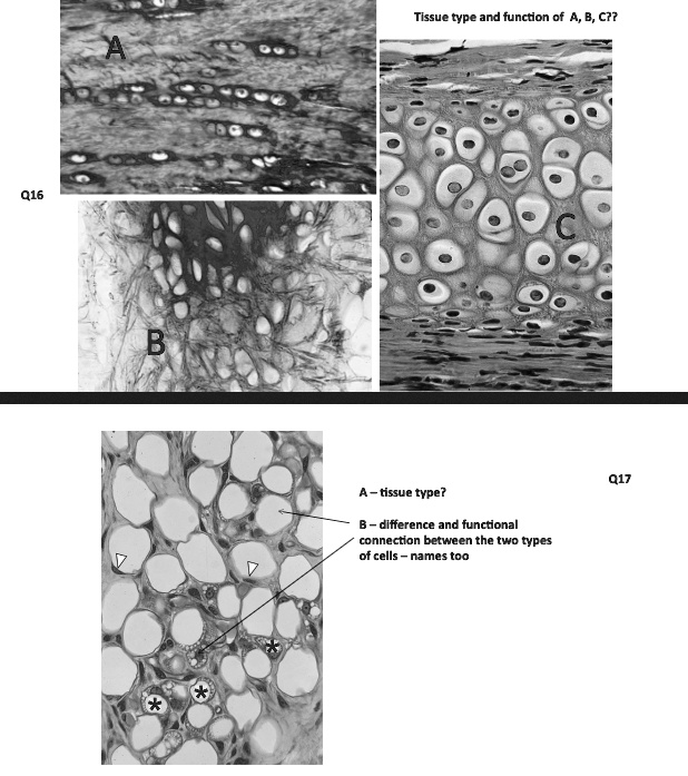 SOLVED: Tissue Type And Function Of A, B, C7? A - Tissue Type ...