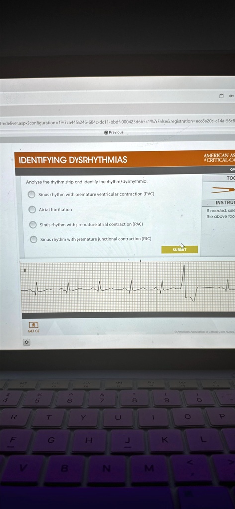 SOLVED: IDENTIFYING DYSRHYTHMIAS Analyze the rhythm strip and identify ...