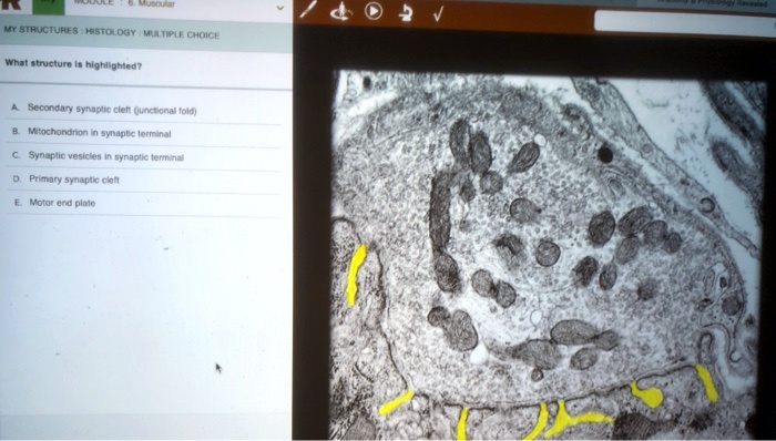 6. Muscular
MY STRUCTURES: HISTOLOGY MULTIPLE CHOICE
What structure is highlighted?
A. Secondary synaptic cleft (junctional fold)
B. Mitochondrion in synaptic terminal
C. Synaptic vesicles in synaptic terminal
D. Primary synaptic cleft
E. Motor end plate