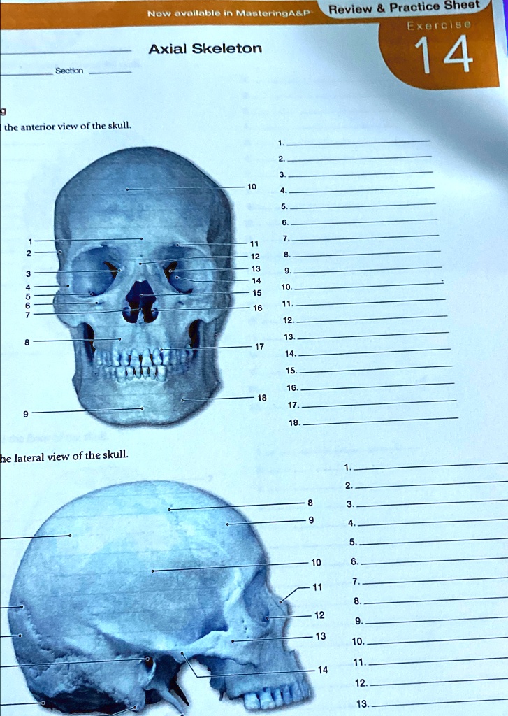 Now available in MasteringA P Review Practice Sheet Exercise Axial ...