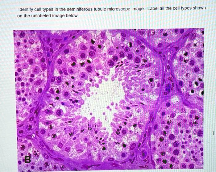 SOLVED: Identify cell types in (he seminiferous tubule microscope image ...