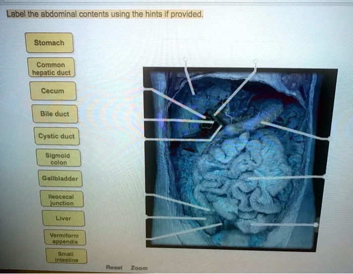 SOLVED Label the abdominal contents using the hints provided. Stomach