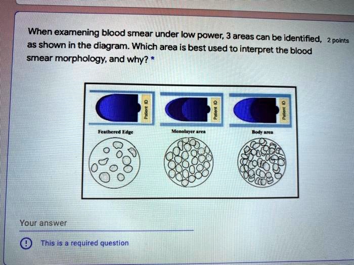 SOLVED When examining a blood smear under low power, three areas can