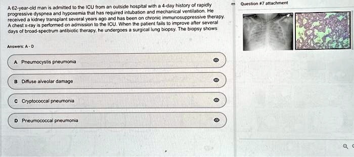 SOLVED: A 62-year-old man is admitted to the ICU from an outside ...