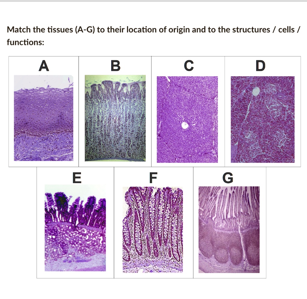 SOLVED duodenum esophagus ileum jejunum liver pancreas stomach acinar