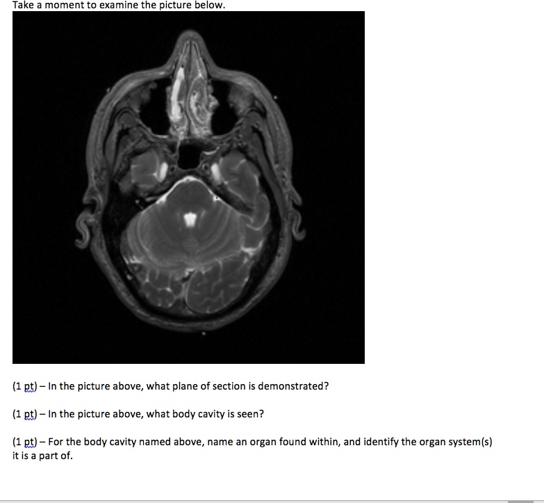Take a moment to examine the picture below.
In the picture above, what plane of section is demonstrated?
In the picture above, what body cavity is seen?
For the body cavity named above, name an organ found within, and identify the organ system(s) it is a part of.