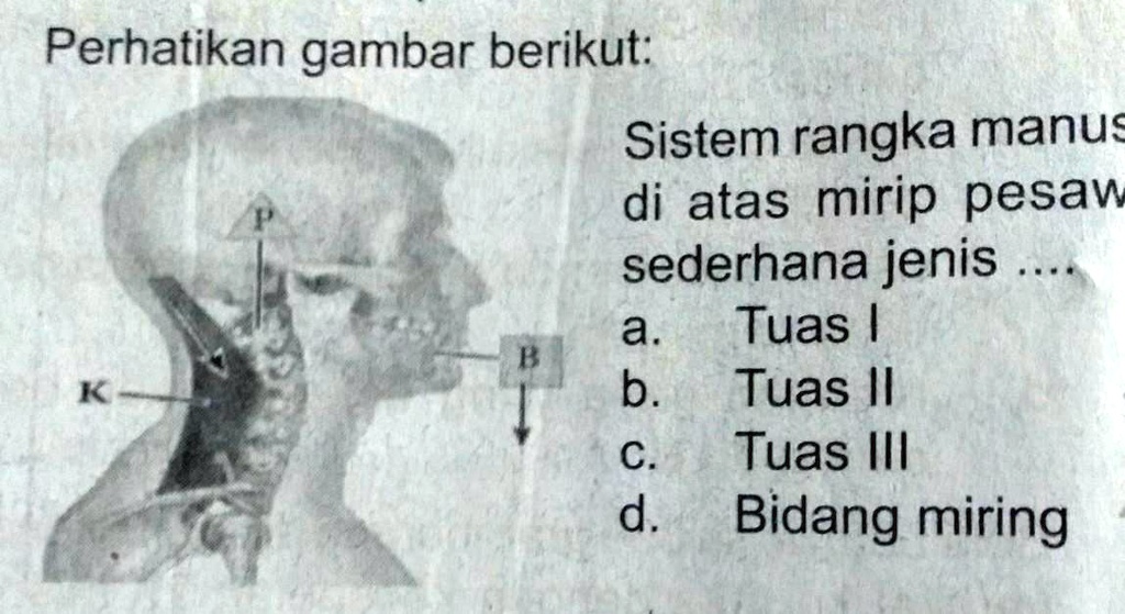 SOLVED: Perhatikan Gambar Berikut:Sistem Rangka Manusiadi Atas Mirip ...