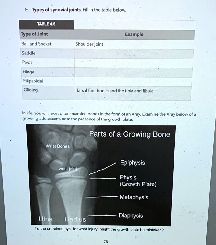 SOLVED 'Types of synovial joints. Fill in the table below TABLE 4.5
