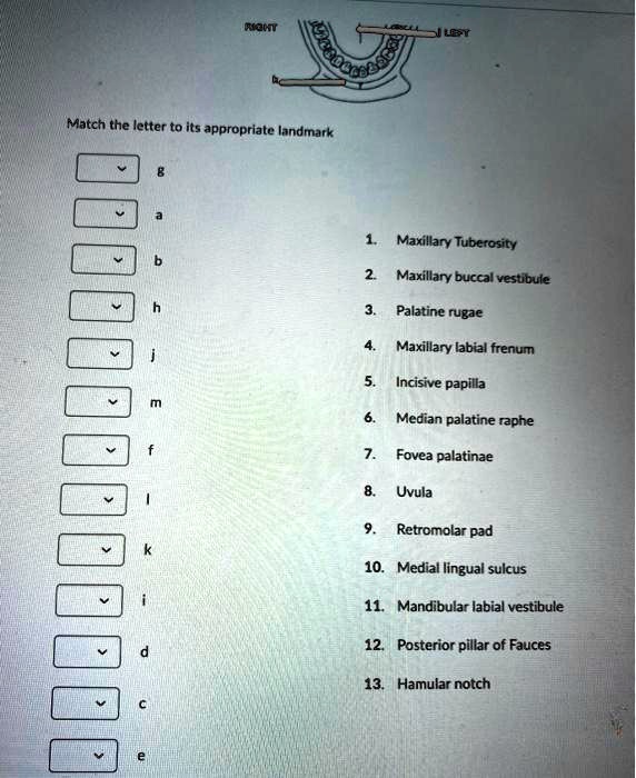 SOLVED Match the letter to its appropriate landmark Maxillary